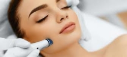 Microdermabrasion